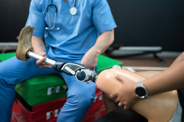 Negativa de cobertura de Órteses e Próteses: O que fazer? - Taveira Advogados - Advocacia Previdenciária - Especialistas em INSS